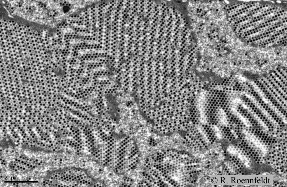 Particles of iridescent virus in cell of copepod (Gladioferens pectinatus)